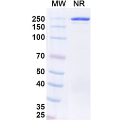 SDS-PAGE - Ofatumumab Biosimilar - Anti-CD20 Antibody - BSA and Azide free (A338976) - Antibodies.com