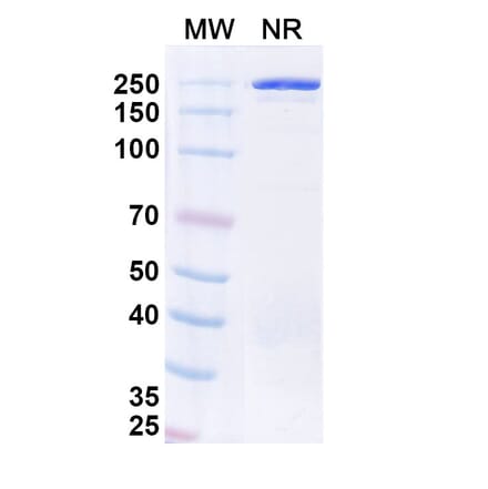 SDS-PAGE - Ofatumumab Biosimilar - Anti-CD20 Antibody - BSA and Azide free (A338976) - Antibodies.com