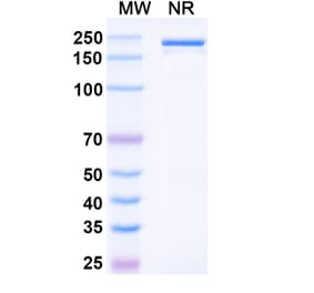 SDS-PAGE - Denosumab Biosimilar - Anti-RANKL Antibody - BSA and Azide free (A338978) - Antibodies.com