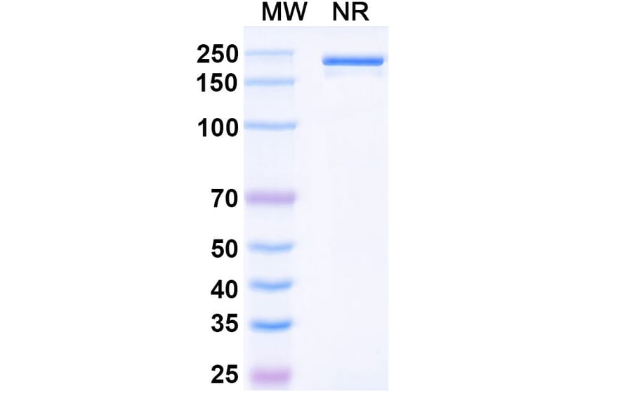 SDS-PAGE - Denosumab Biosimilar - Anti-RANKL Antibody - BSA and Azide free (A338978) - Antibodies.com