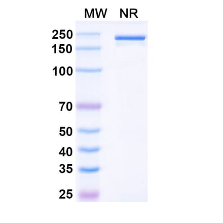 SDS-PAGE - Denosumab Biosimilar - Anti-RANKL Antibody - BSA and Azide free (A338978) - Antibodies.com