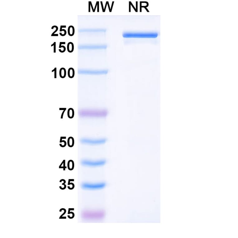 SDS-PAGE - Denosumab Biosimilar - Anti-RANKL Antibody - BSA and Azide free (A338978) - Antibodies.com