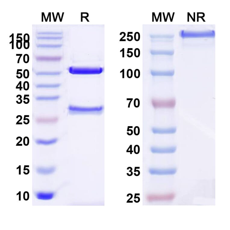 SDS-PAGE - Tocilizumab Biosimilar - Anti-CD126 Antibody - BSA and Azide free (A338979) - Antibodies.com