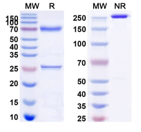 SDS-PAGE - Brentuximab Biosimilar - Anti-CD30 Antibody - BSA and Azide free (A338981) - Antibodies.com
