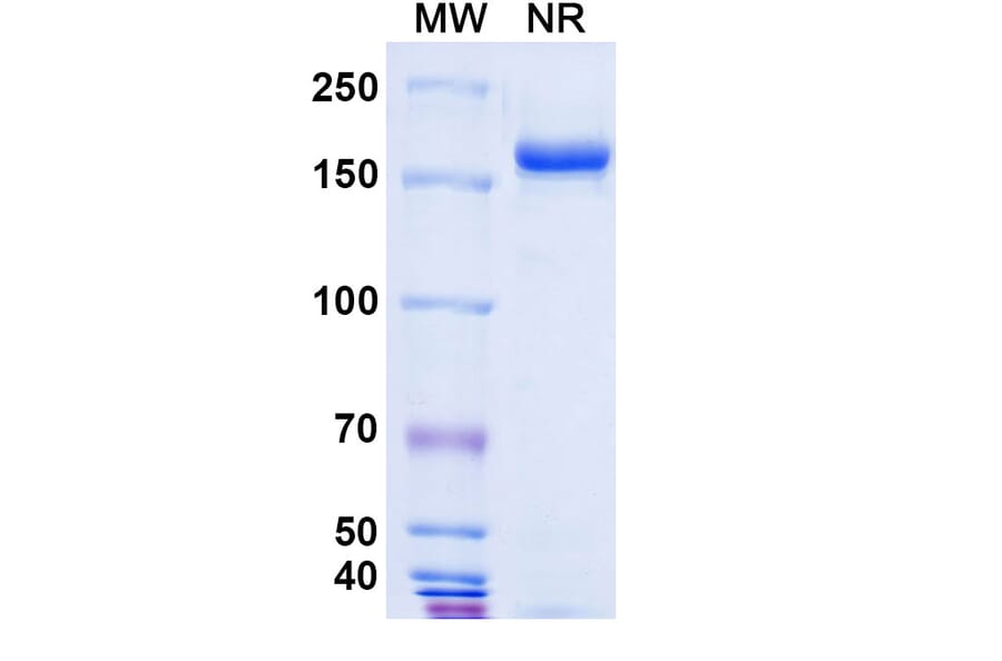 SDS-PAGE - Pertuzumab Biosimilar - Anti-ErbB2 Antibody - BSA and Azide free (A338983) - Antibodies.com