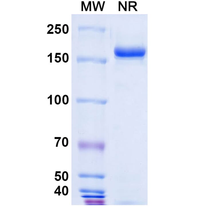 SDS-PAGE - Pertuzumab Biosimilar - Anti-ErbB2 Antibody - BSA and Azide free (A338983) - Antibodies.com