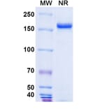 SDS-PAGE - Pertuzumab Biosimilar - Anti-ErbB2 Antibody - BSA and Azide free (A338983) - Antibodies.com