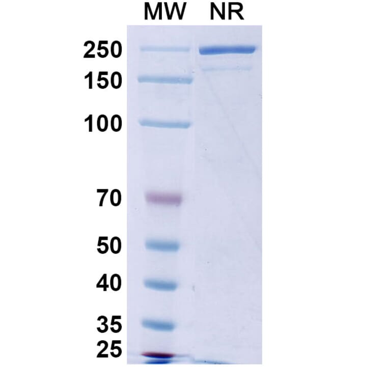 SDS-PAGE - Obinutuzumab Biosimilar - Anti-CD20 Antibody - BSA and Azide free (A338985) - Antibodies.com