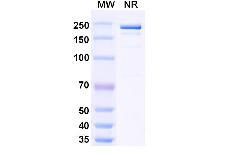 SDS-PAGE - Siltuximab Biosimilar - Anti-IL-6 Antibody - BSA and Azide free (A338988) - Antibodies.com