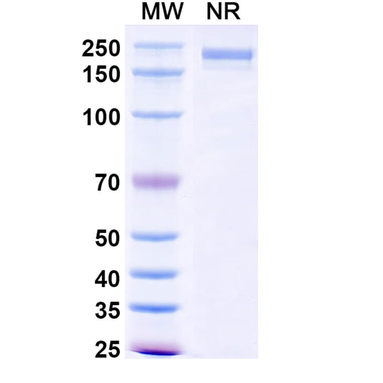 SDS-PAGE - Dinutuximab Biosimilar - Anti-Ganglioside GD2 Antibody - BSA and Azide free (A338992) - Antibodies.com