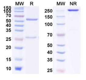SDS-PAGE - Evolocumab Biosimilar - Anti-PCSK9 Antibody - BSA and Azide free (A338994) - Antibodies.com