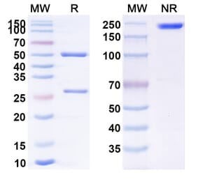 SDS-PAGE - Imciromab Biosimilar - Anti-MYH6 Antibody - BSA and Azide free (A338995) - Antibodies.com
