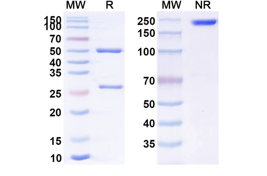 SDS-PAGE - Imciromab Biosimilar - Anti-MYH6 Antibody - BSA and Azide free (A338995) - Antibodies.com