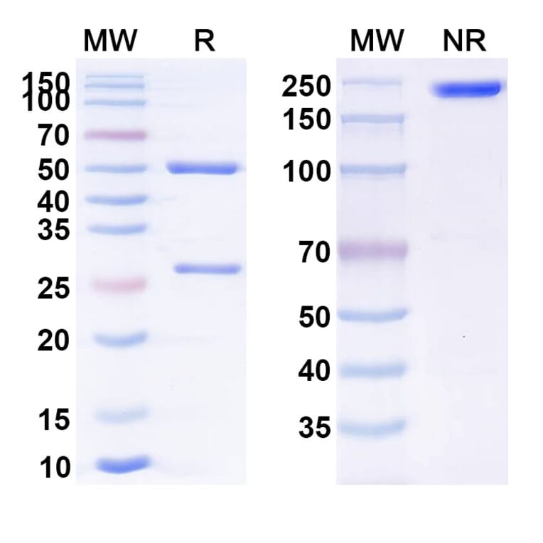 SDS-PAGE - Imciromab Biosimilar - Anti-MYH6 Antibody - BSA and Azide free (A338995) - Antibodies.com