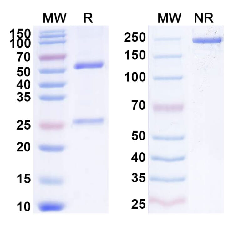 SDS-PAGE - Necitumumab Biosimilar - Anti-EGFR Antibody - BSA and Azide free (A338996) - Antibodies.com