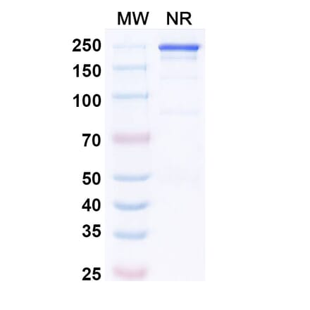 SDS-PAGE - Secukinumab Biosimilar - Anti-IL-17A Antibody - BSA and Azide free (A338998) - Antibodies.com