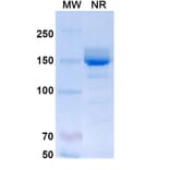SDS-PAGE - Mepolizumab Biosimilar - Anti-IL-5 Antibody - BSA and Azide free (A339000) - Antibodies.com