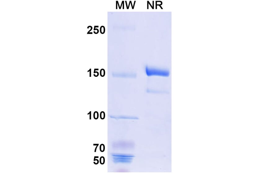 SDS-PAGE - Benralizumab Biosimilar - Anti-IL-5RA Antibody - BSA and Azide free (A339006) - Antibodies.com