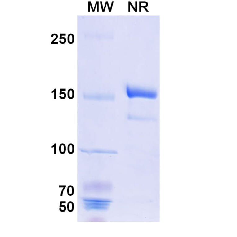 SDS-PAGE - Benralizumab Biosimilar - Anti-IL-5RA Antibody - BSA and Azide free (A339006) - Antibodies.com