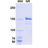SDS-PAGE - Benralizumab Biosimilar - Anti-IL-5RA Antibody - BSA and Azide free (A339006) - Antibodies.com