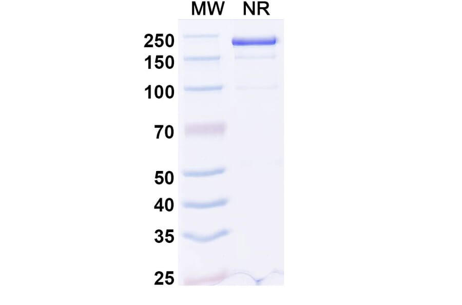 SDS-PAGE - Dupilumab Biosimilar - Anti-IL-4R Antibody - BSA and Azide free (A339008) - Antibodies.com
