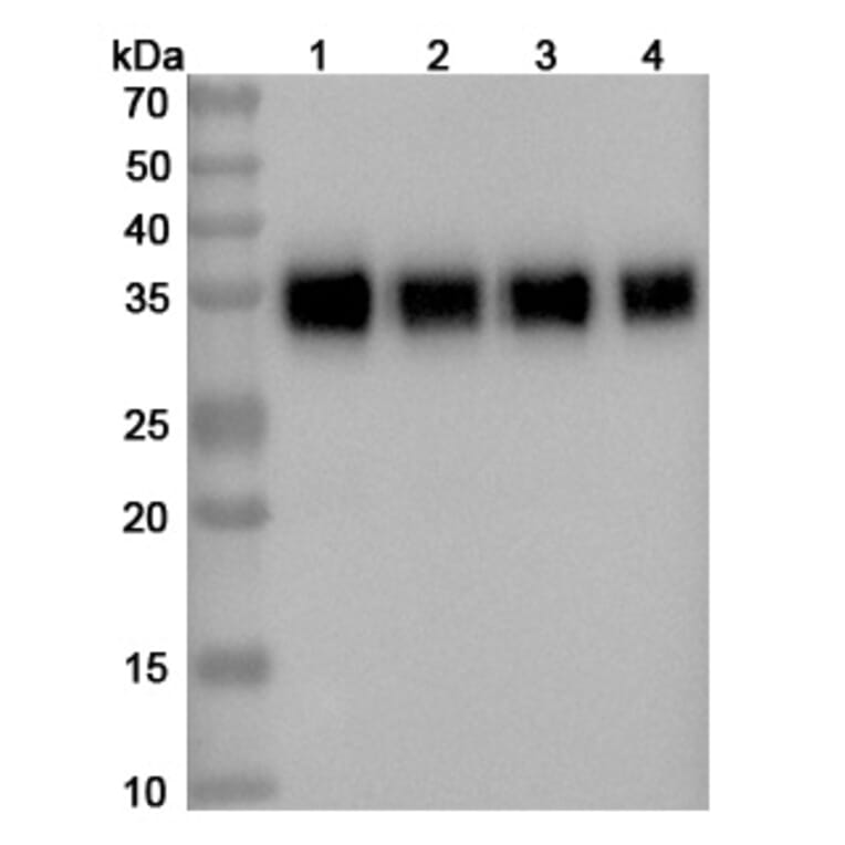 SDS-PAGE - Durvalumab Biosimilar - Anti-PD-L1 Antibody - BSA and Azide free (A339009) - Antibodies.com