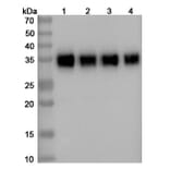 SDS-PAGE - Durvalumab Biosimilar - Anti-PD-L1 Antibody - BSA and Azide free (A339009) - Antibodies.com