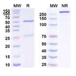 SDS-PAGE - Sarilumab Biosimilar - Anti-CD126 Antibody - BSA and Azide free (A339014) - Antibodies.com