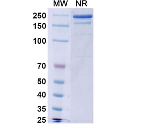 SDS-PAGE - Burosumab Biosimilar - Anti-FGF23 Antibody - BSA and Azide free (A339015) - Antibodies.com