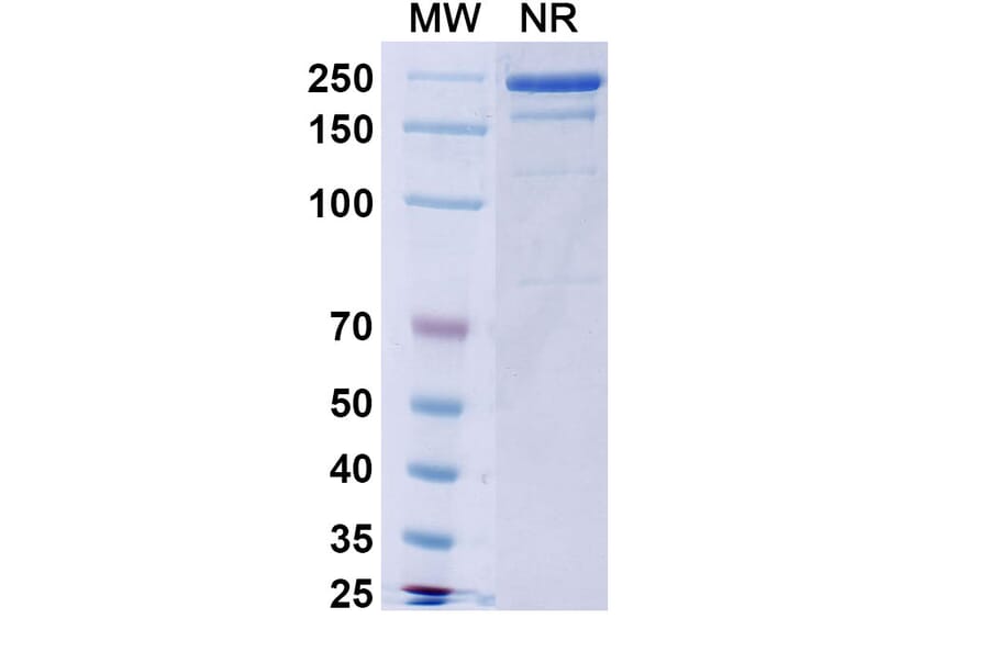 SDS-PAGE - Burosumab Biosimilar - Anti-FGF23 Antibody - BSA and Azide free (A339015) - Antibodies.com