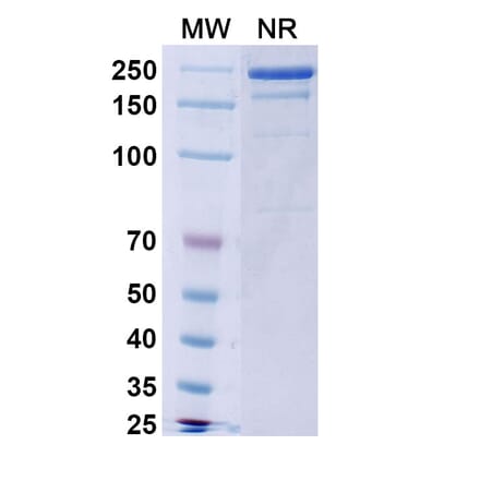 SDS-PAGE - Burosumab Biosimilar - Anti-FGF23 Antibody - BSA and Azide free (A339015) - Antibodies.com