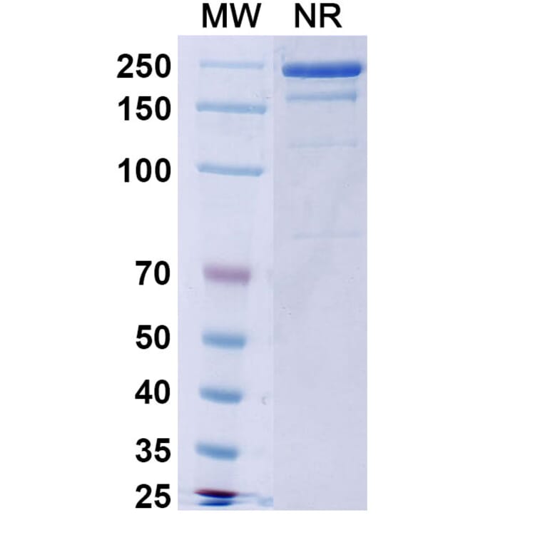 SDS-PAGE - Burosumab Biosimilar - Anti-FGF23 Antibody - BSA and Azide free (A339015) - Antibodies.com