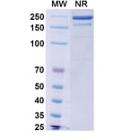 SDS-PAGE - Burosumab Biosimilar - Anti-FGF23 Antibody - BSA and Azide free (A339015) - Antibodies.com