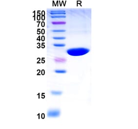 SDS-PAGE - Caplacizumab Biosimilar - Anti-VWF Antibody - BSA and Azide free (A339016) - Antibodies.com
