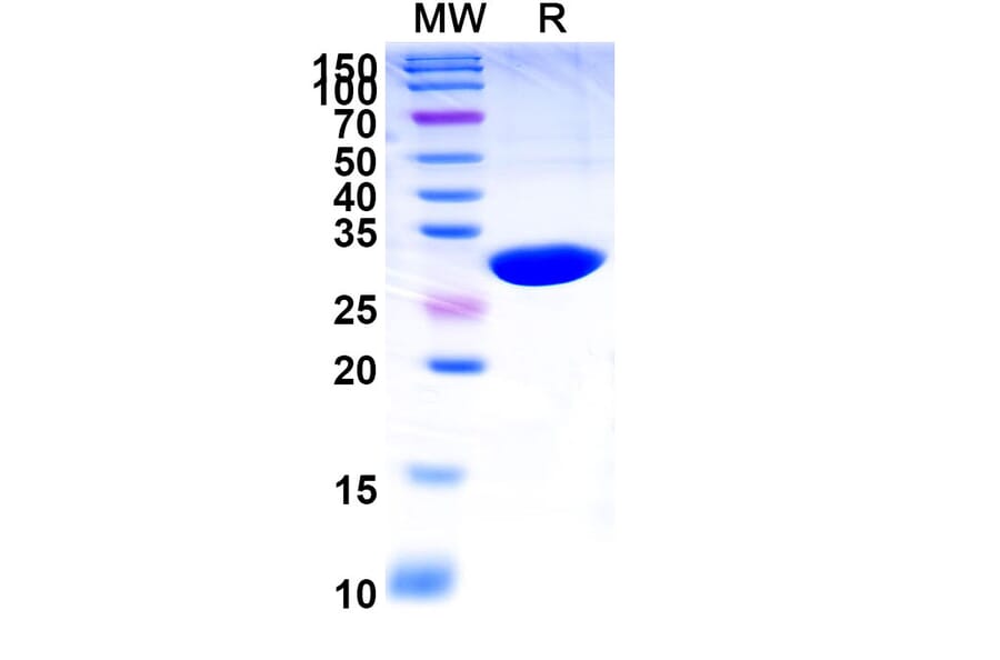 SDS-PAGE - Caplacizumab Biosimilar - Anti-VWF Antibody - BSA and Azide free (A339016) - Antibodies.com