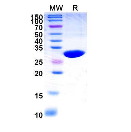 SDS-PAGE - Caplacizumab Biosimilar - Anti-VWF Antibody - BSA and Azide free (A339016) - Antibodies.com
