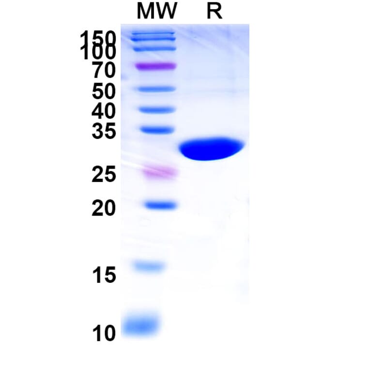 SDS-PAGE - Caplacizumab Biosimilar - Anti-VWF Antibody - BSA and Azide free (A339016) - Antibodies.com