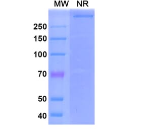 SDS-PAGE - Emapalumab Biosimilar - Anti-IFN gamma Antibody - BSA and Azide free (A339018) - Antibodies.com