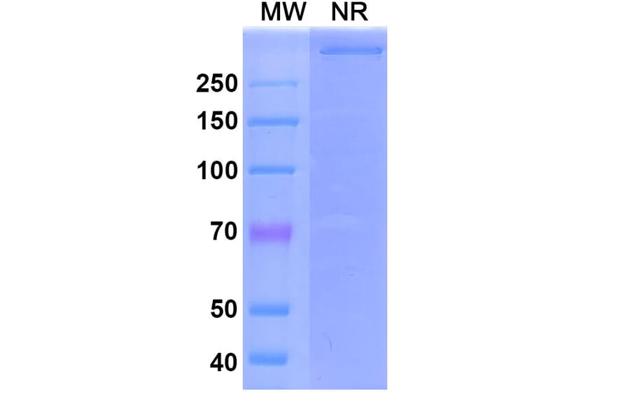 SDS-PAGE - Emapalumab Biosimilar - Anti-IFN gamma Antibody - BSA and Azide free (A339018) - Antibodies.com