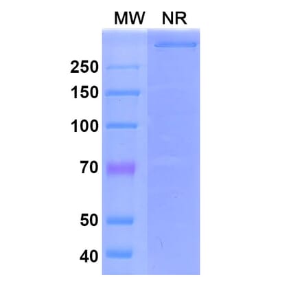 SDS-PAGE - Emapalumab Biosimilar - Anti-IFN gamma Antibody - BSA and Azide free (A339018) - Antibodies.com