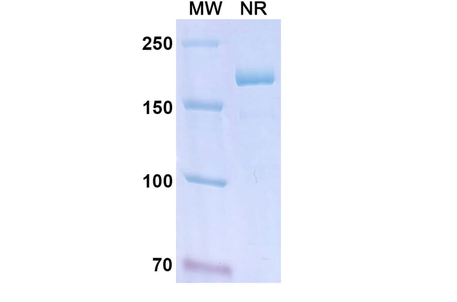 SDS-PAGE - Lanadelumab Biosimilar - Anti-KLKB1 Antibody - BSA and Azide free (A339023) - Antibodies.com
