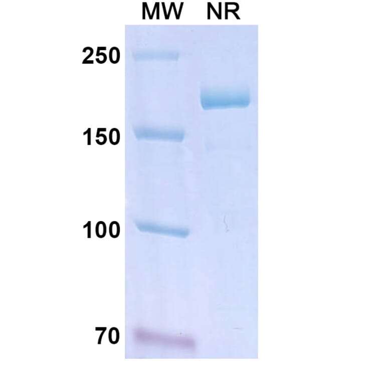 SDS-PAGE - Lanadelumab Biosimilar - Anti-KLKB1 Antibody - BSA and Azide free (A339023) - Antibodies.com