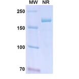 SDS-PAGE - Lanadelumab Biosimilar - Anti-KLKB1 Antibody - BSA and Azide free (A339023) - Antibodies.com
