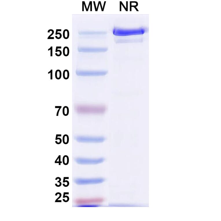 SDS-PAGE - Polatuzumab Biosimilar - Anti-CD79b Antibody - BSA and Azide free (A339028) - Antibodies.com