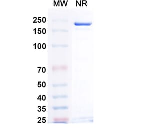 SDS-PAGE - Teprotumumab Biosimilar - Anti-IGF1R Antibody - BSA and Azide free (A339033) - Antibodies.com