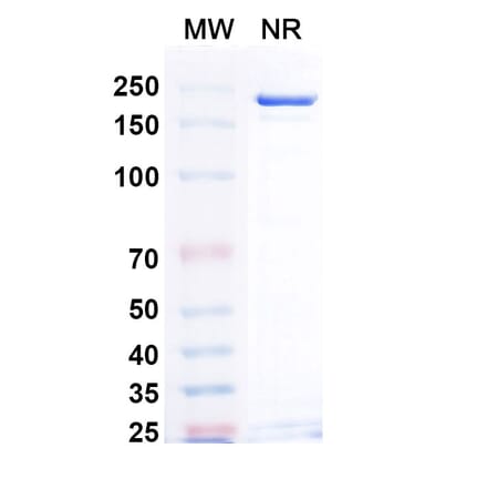 SDS-PAGE - Teprotumumab Biosimilar - Anti-IGF1R Antibody - BSA and Azide free (A339033) - Antibodies.com