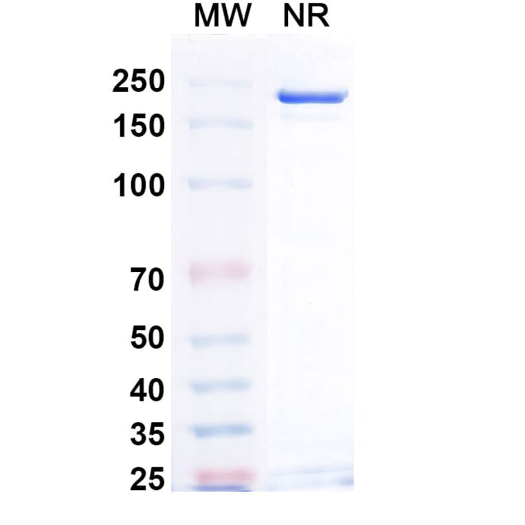 SDS-PAGE - Teprotumumab Biosimilar - Anti-IGF1R Antibody - BSA and Azide free (A339033) - Antibodies.com