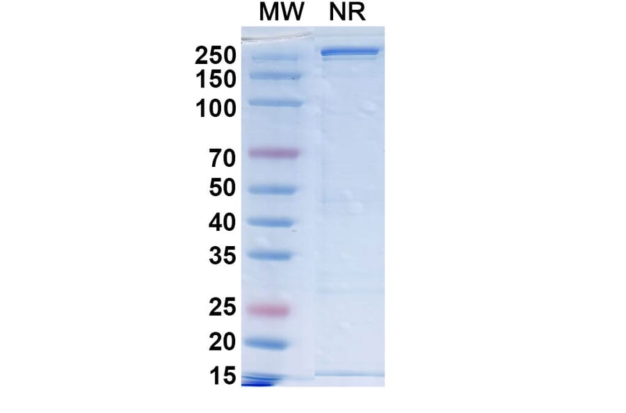 SDS-PAGE - Sacituzumab Biosimilar - Anti-TROP2 Antibody - BSA and Azide free (A339036) - Antibodies.com