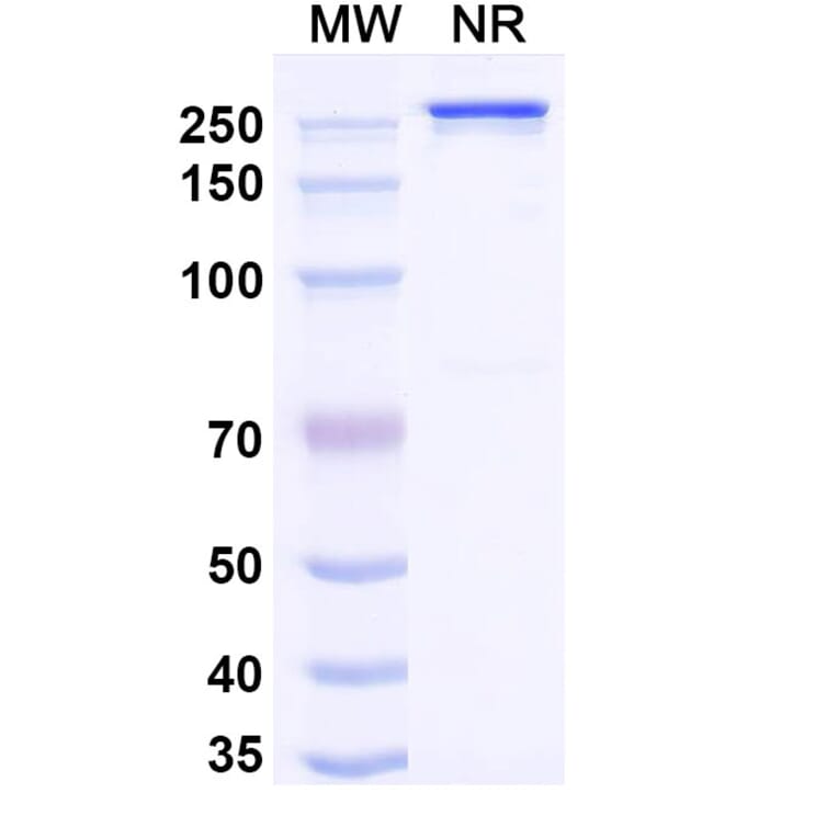 SDS-PAGE - Naxitamab Biosimilar - Anti-Ganglioside GD2 Antibody - BSA and Azide free (A339044) - Antibodies.com