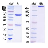 SDS-PAGE - DQB1-FL8 Biosimilar - Anti-HLA-DQB1 Antibody - BSA and Azide free (A339052) - Antibodies.com